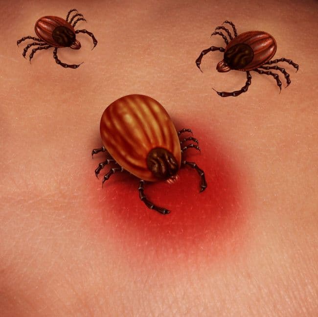 lyme-disease-tick-ozone-therapy