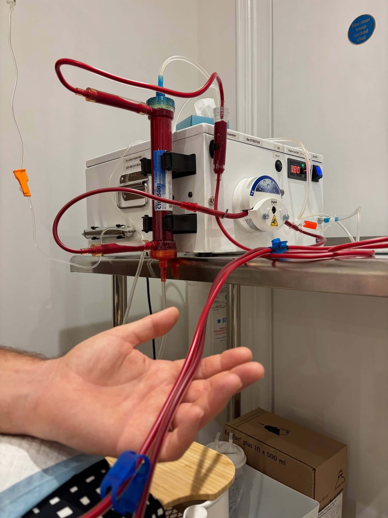 EBOO blood filtration therapy machine at IV Drip Clinic London